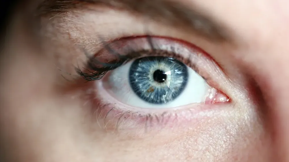 Alerjik göz reaksiyonlarına dikkat! Tedavi edilmezse kornea nakline kadar ilerleyebilir