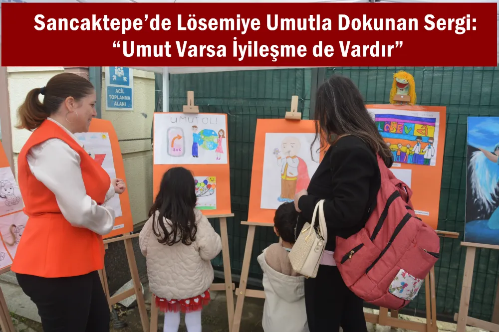 Sancaktepe’de Lösemiye Umutla Dokunan Sergi: “Umut Varsa İyileşme de Vardır”